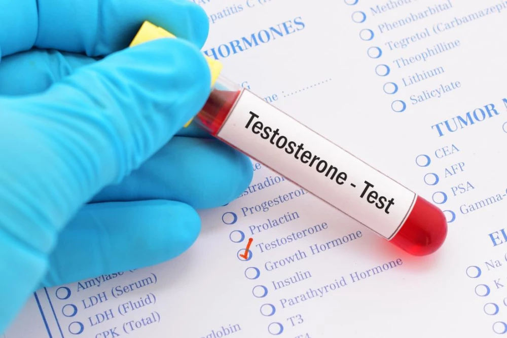 Testosterone Home Blood Test